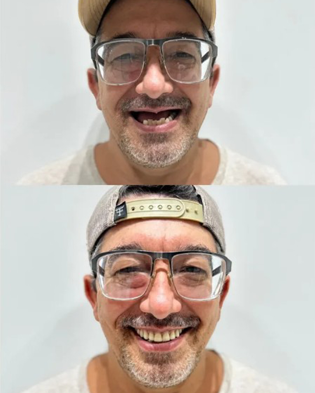 Antes e Depois — Caso 1