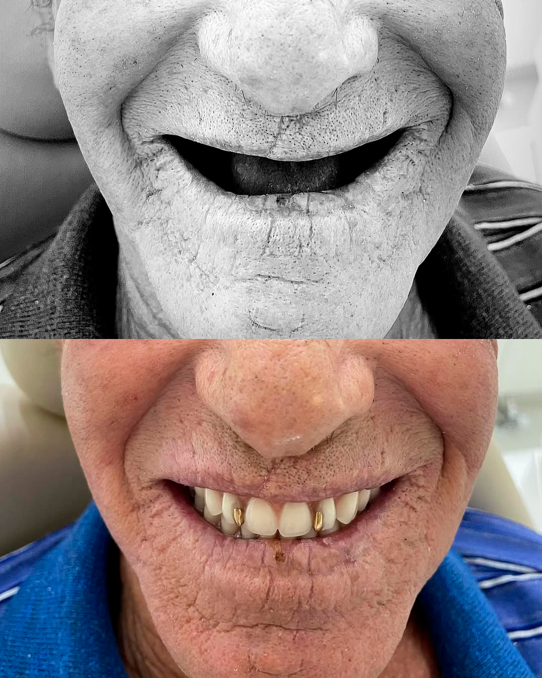 Antes e Depois — Caso 4